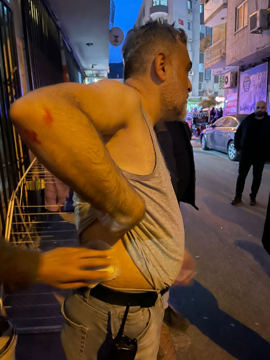 Gazeteci Kavgayı ayırırken saldırıya uğradı